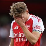 Odegaard Injury Scare Hits Arsenal in Leeds Clash 2 GettyImages 2228858131