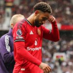 Matheus Cunha Injury Rocks Man Utd in Crucial Burnley Clash 3 GettyImages 2232858660