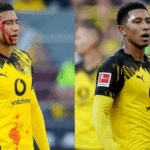 Jobe Bellingham Bloodied After Brutal Clash in Dortmund Victory 2 GOAL20 20Multiple20Images20 20220Split20 20Facebook2012