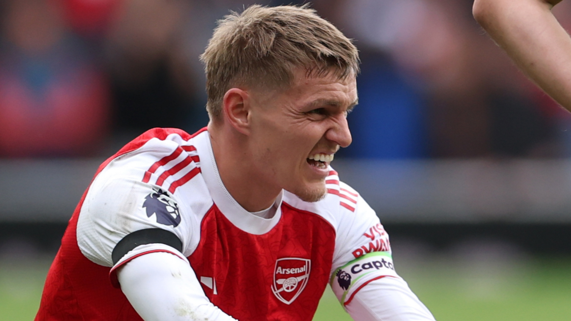 Odegaard Injury Update Raises Arsenal Fitness Concerns 2 GOAL20 20Blank20WEB20 20Facebook20 202025 10 05T172727.382 1