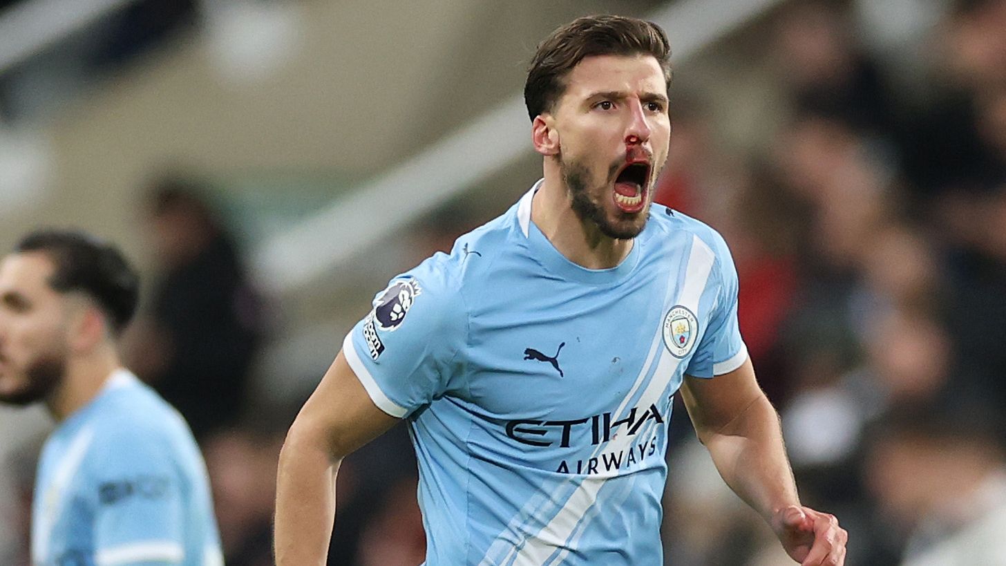 Ruben Dias Demands Premier League VAR Clarity After Newcastle Defeat 6 GettyImages 2247961880