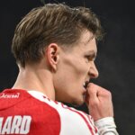 Odegaard Injury Leaves Arsenal Without Captain for Chelsea Clash 2 GettyImages 2258855042