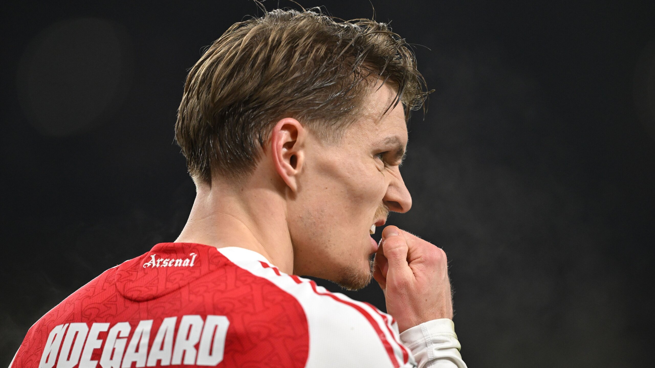 Odegaard Injury Leaves Arsenal Without Captain for Chelsea Clash 5 GettyImages 2258855042 scaled