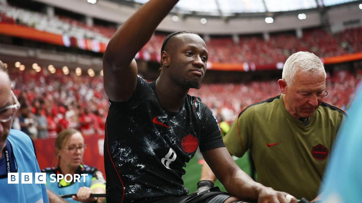 Canada midfielder Ismael Kone thanks teammates and fans after broken leg surgery 1 51826660 6c06 11f1 8546 8f19e4fe30f4